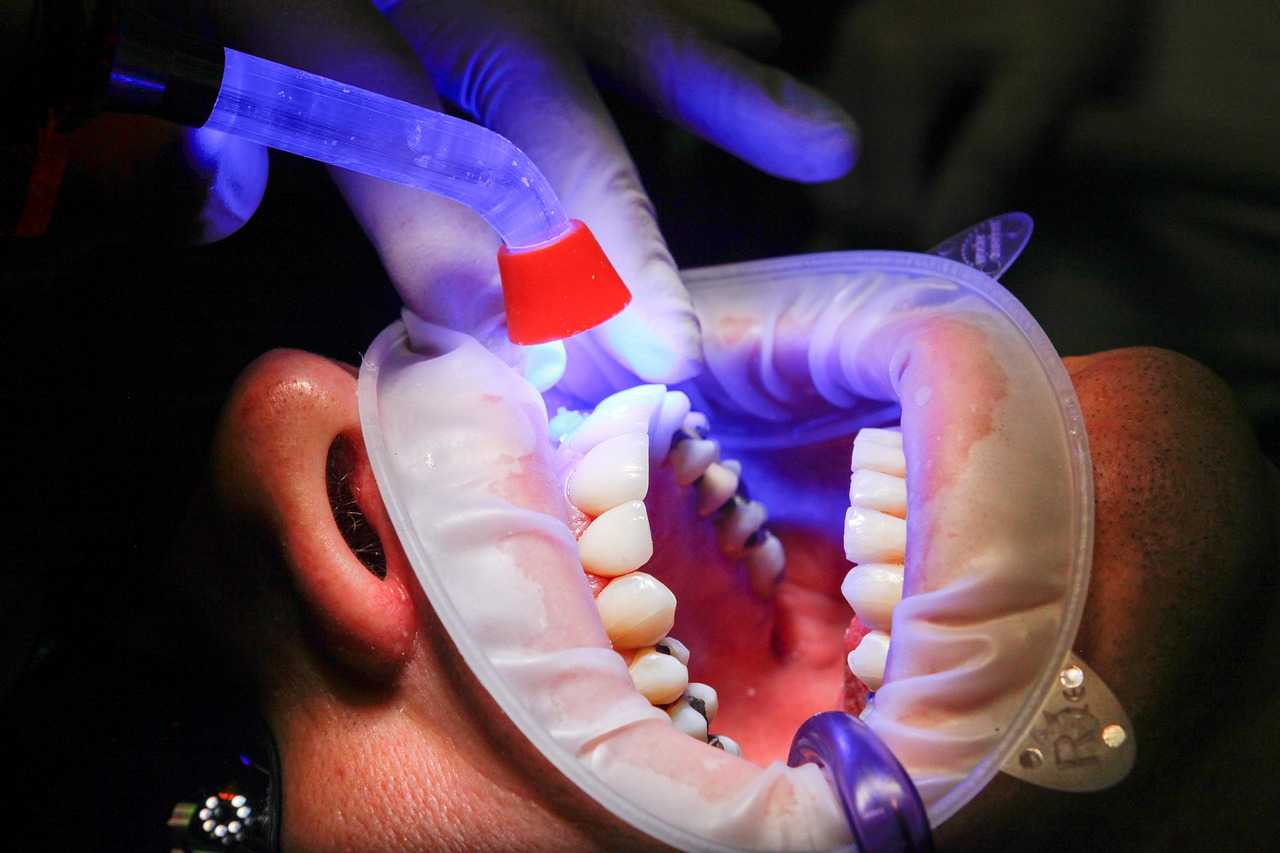 best root canal dentist near me best root canal dentist near me