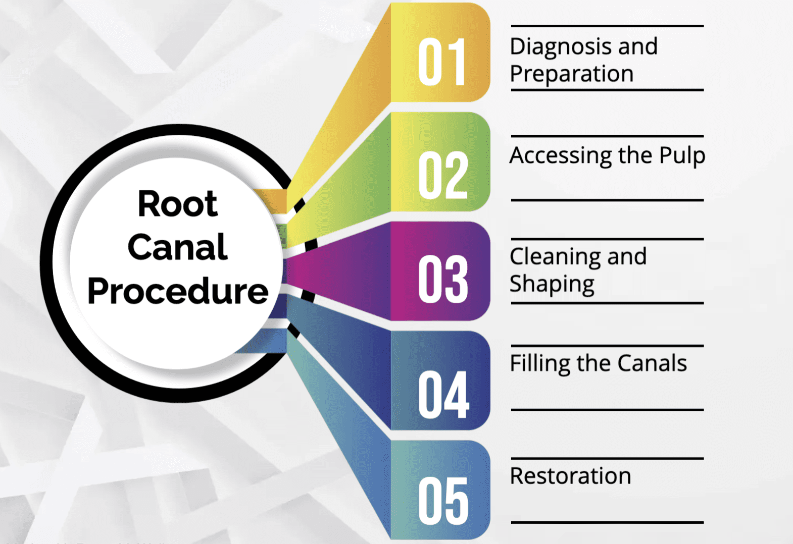 The Root Canal Procedure 