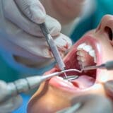 dentist and patient during endodontic retreatment